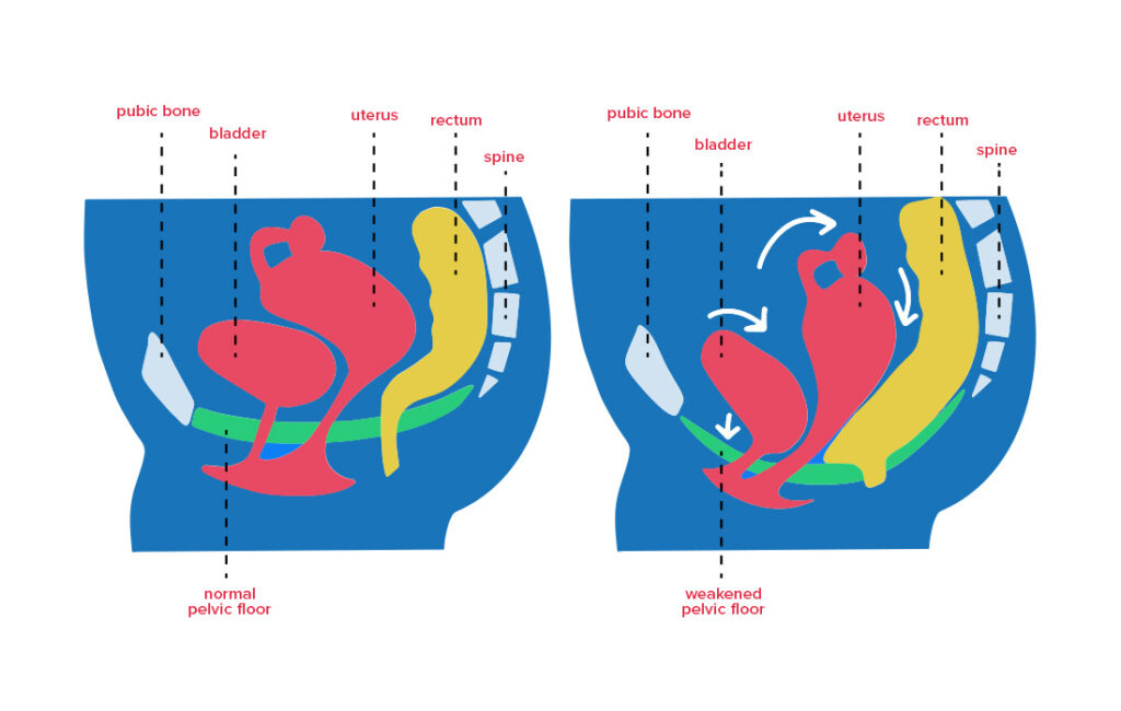 pelvic floor graphic